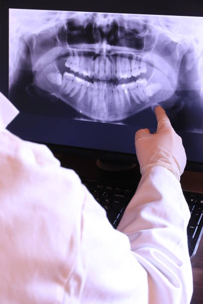 Best Chipped Tooth Repair Near Me  in Temple, TX
