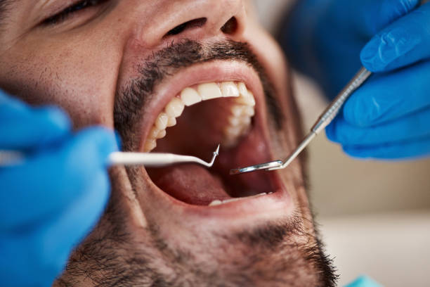 Best Broken Tooth Emergency  in Temple, TX